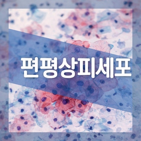 비정형 편평상피세포 이상 원인, 자궁경부암 세포검사