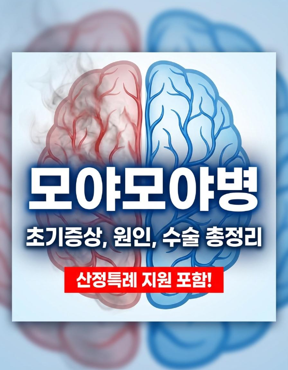 모야모야병 초기증상, 절대 놓치면 안 되는 신호들원인부터 수술 방법·산정특례 지원까지 (2....