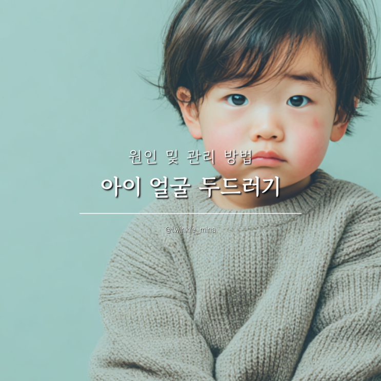  아이 얼굴 두드러기 원인 및 증상 관리 방법