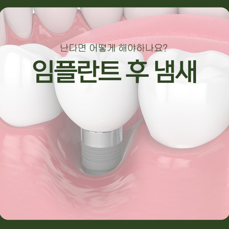  임플란트 후 냄새, 난다면 어떻게 해야하나요?