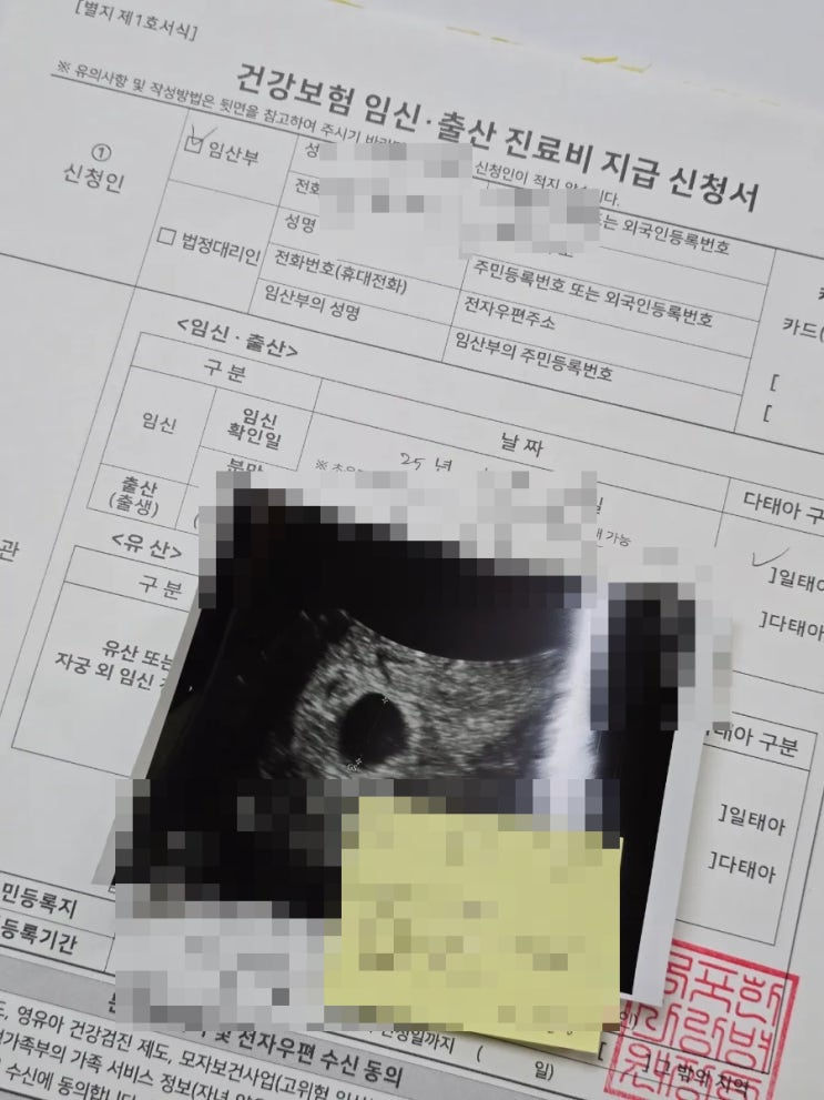  임테기 역전시기 초음파 아기집 집들이 후기 임신초기 증상