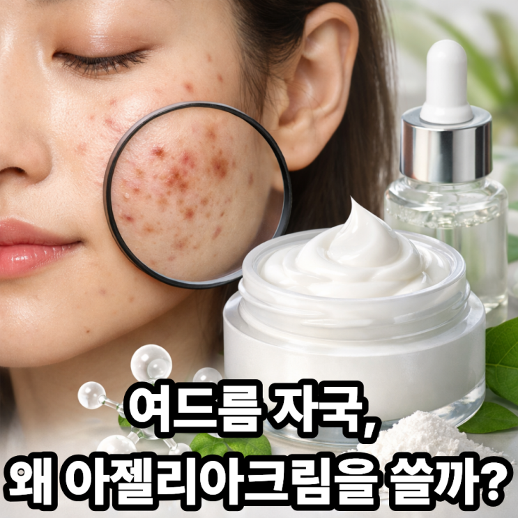  여드름 자국 색소침착에 아젤리아크림이 도움 되는 이유｜피부과 성분 분석