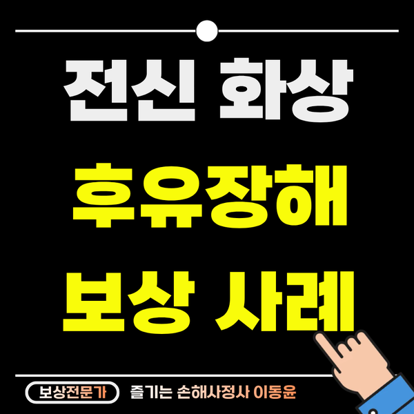  전신 화상 후유장해, 관절 장해로 보상 받은 사례