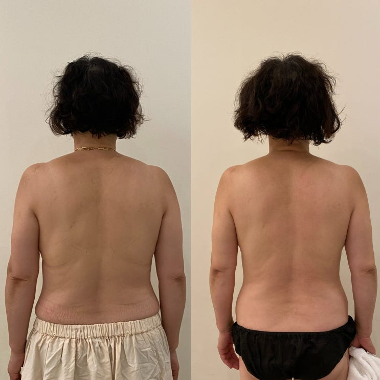 대구 테라노바 달서구 전신관리 바디 부스터 보니예