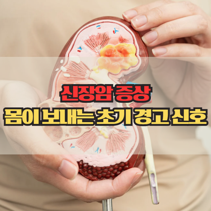  신장암 증상, 몸이 보내는 초기 경고 신호 5가지