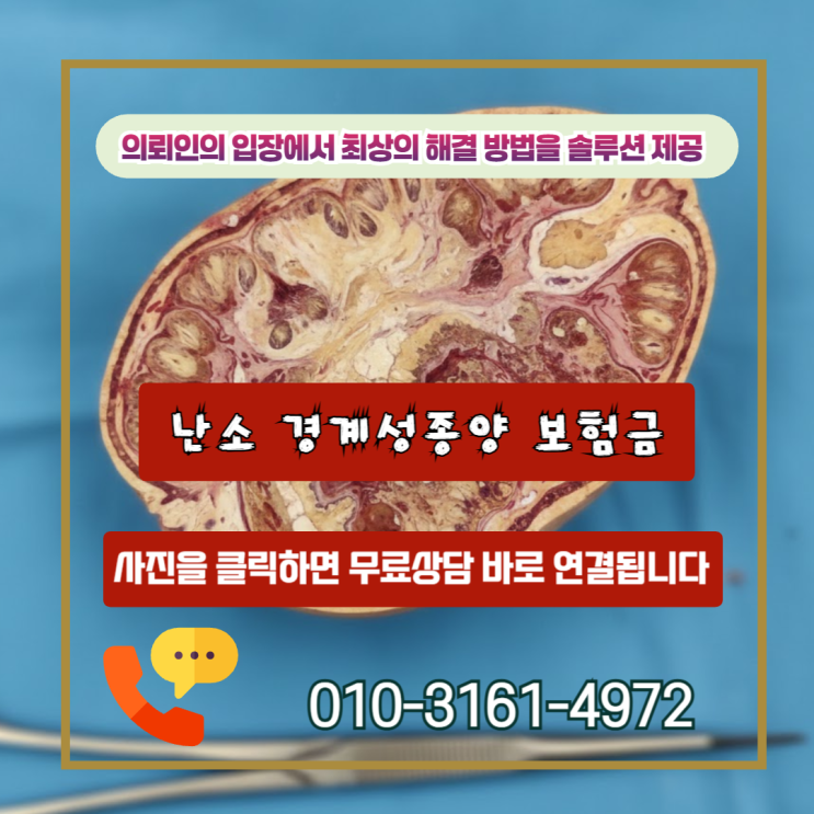  난소 경계성종양 보험금, 100% 다 받는 방법은 따로 있습니다