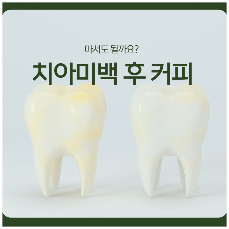  치아미백 후 커피, 마셔도 될까요?
