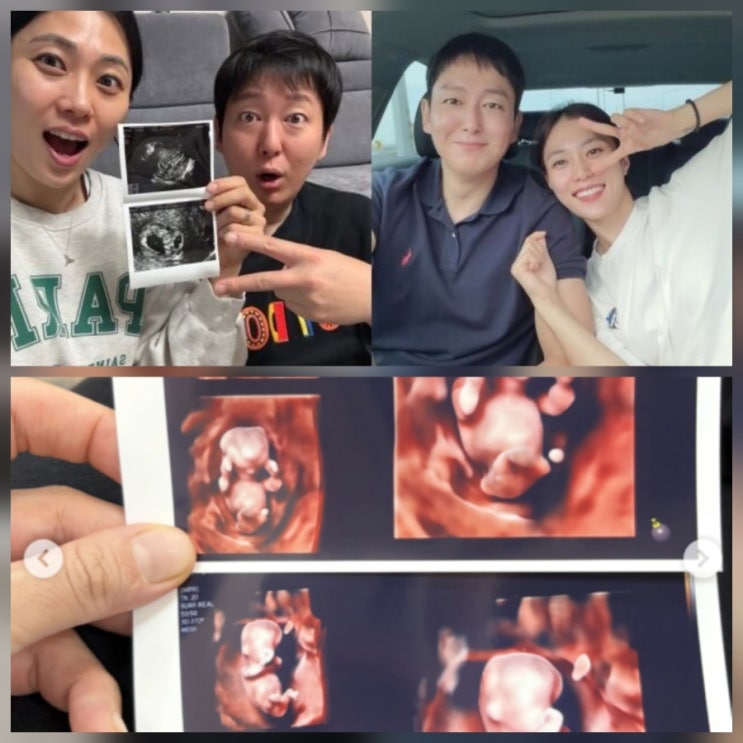 이동진 김지연 쌍둥이 임신 누구 나이 프로필