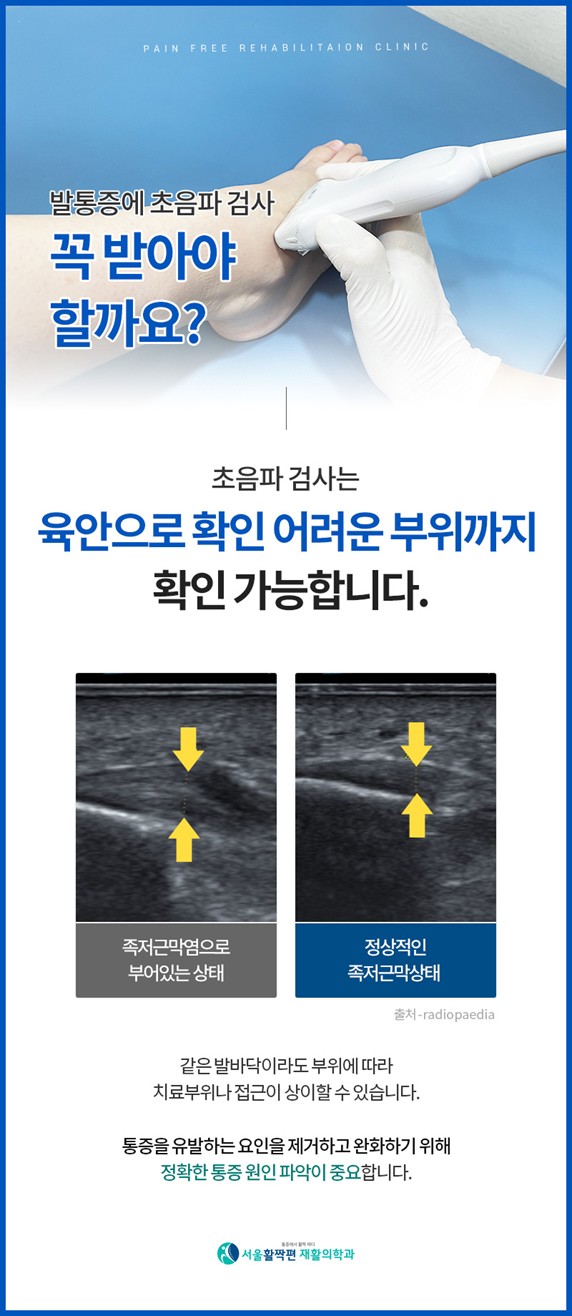 When foot pain becomes intense — 본문 그림