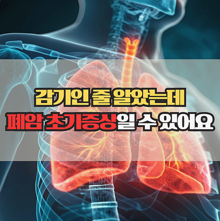  폐암 초기증상, 감기과 헷갈리기 쉬운 신호들