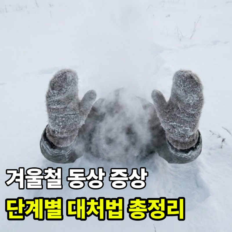 겨울철 동상 증상과 단계별 대처법 총정리