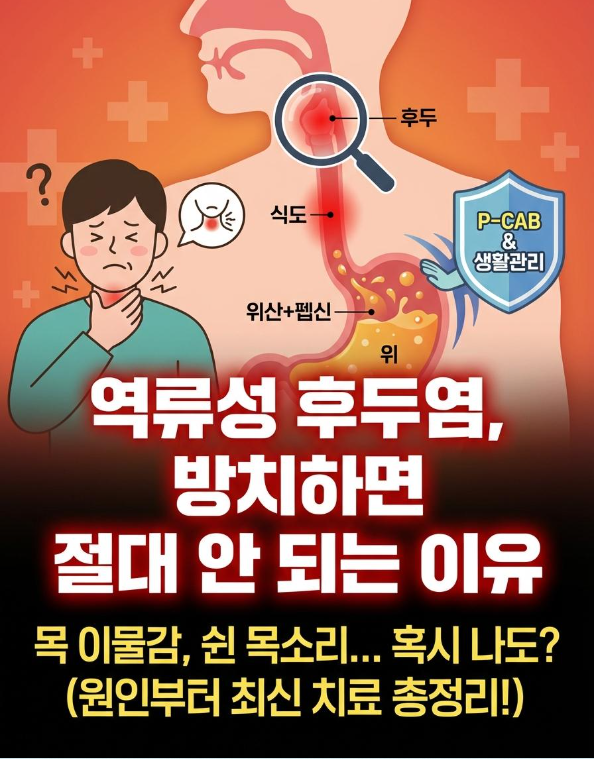 역류성 후두염 초기증상, 방치하면 안 되는 이유(원인부터 2025년 최신 치료·관리까지 정리)
