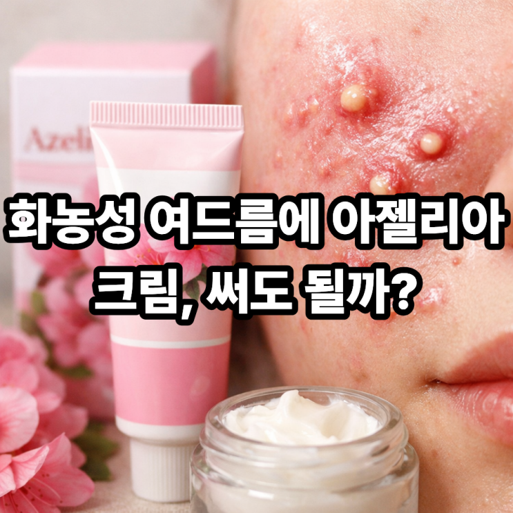  아젤리아크림 화농성 여드름에 써도 될까? 피부과 기준 사용 가이드