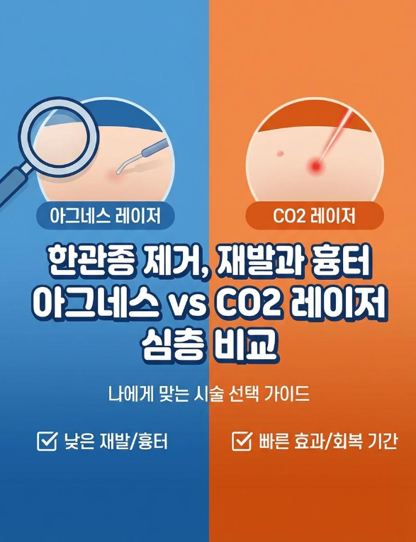한관종 제거, 재발과 흉터가 걱정된다면아그네스 vs CO₂ 레이저, 원리부터 회복까지 제대로 ....