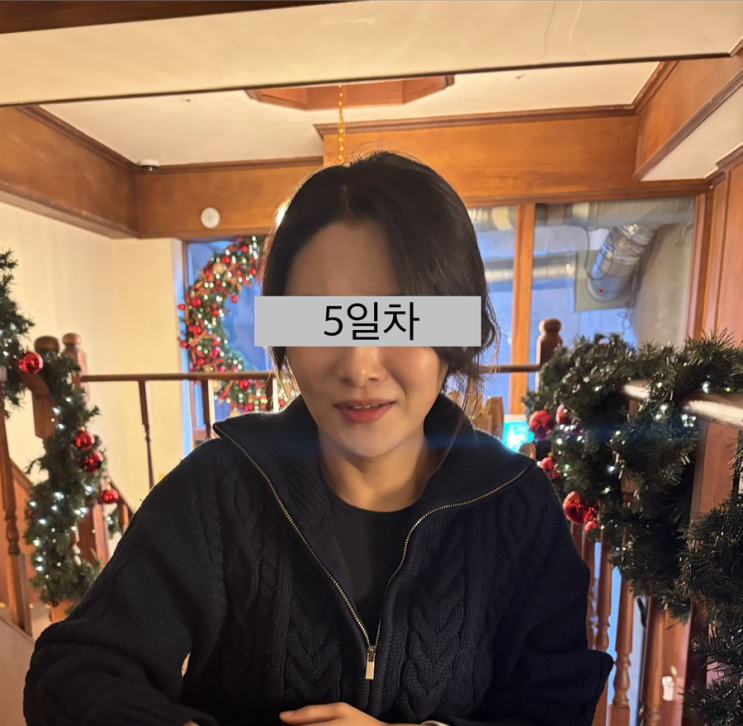  엘라비에 리투오 2차 2주 경과 솔직후기