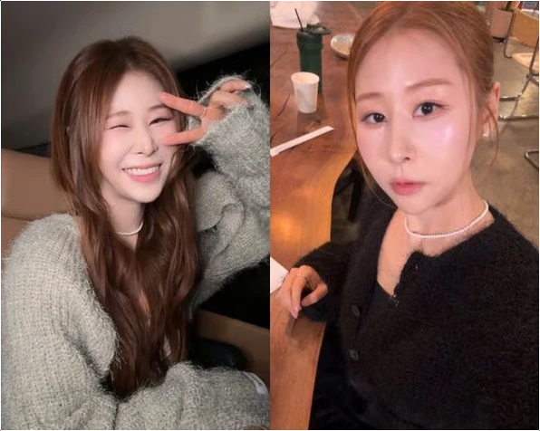  박세미 코 재수술 고백 15년 만에 갈비뼈 이식한 진짜 이유