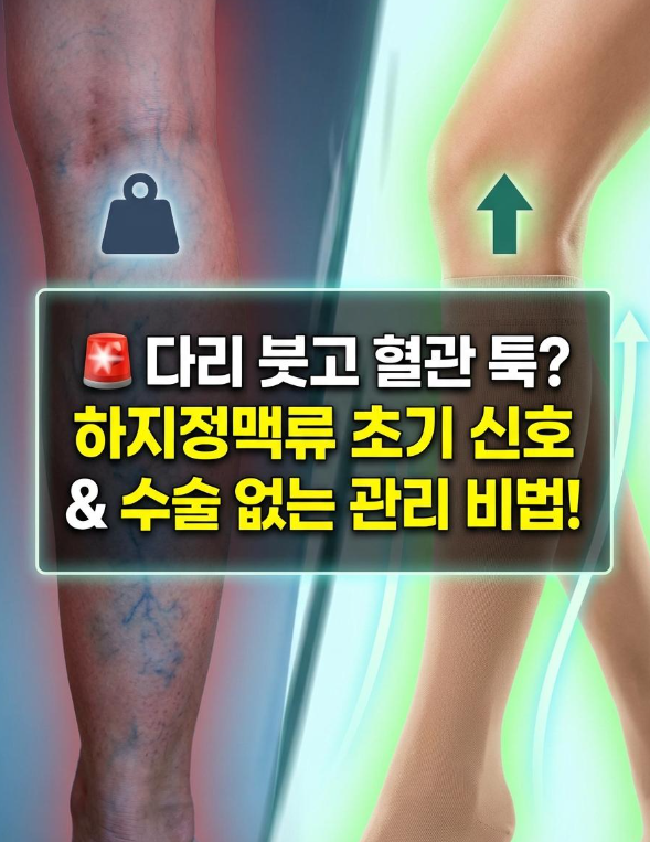 하지정맥류 초기 신호 5가지수술 전, 지금부터 관리하는 종합 가이드