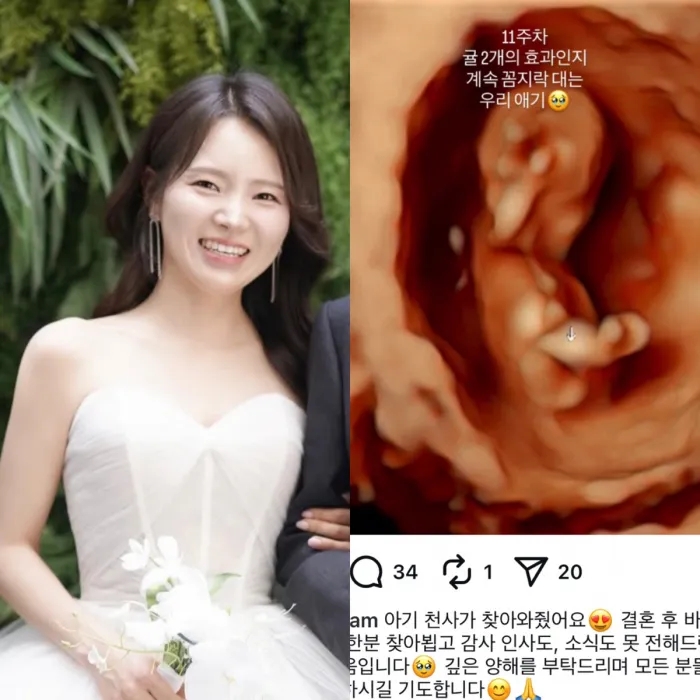나는솔로 19기 영숙, 결혼 직후 임신 사실 공개…11주 초음파 직접 밝혔다
