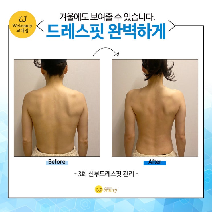  남부터미널 에스테틱, 굽은 등과 어깨 통증? '발로 하는' 등관리의 차이!