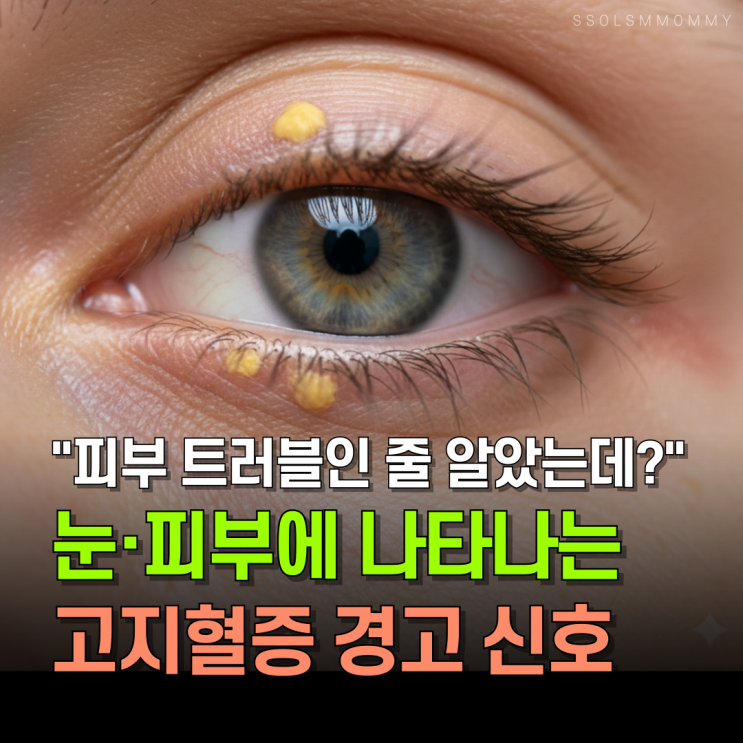  눈/피부에 ‘이 변화’ 보이면 콜레스테롤 신호일 수 있습니다