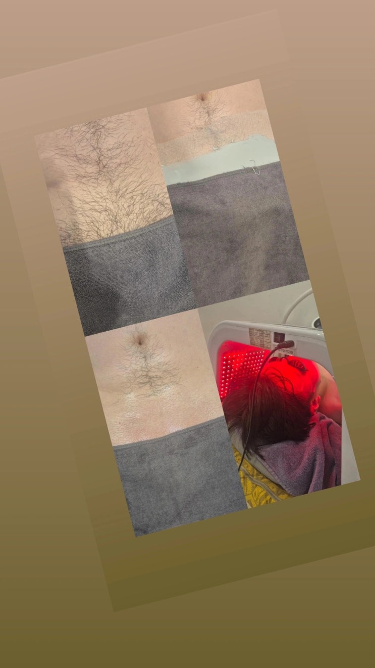  남자 브라질리언 왁싱은 남자 왁서가 맞춤 케어하는 영등포 남자 왁싱샵 "청춘케어"