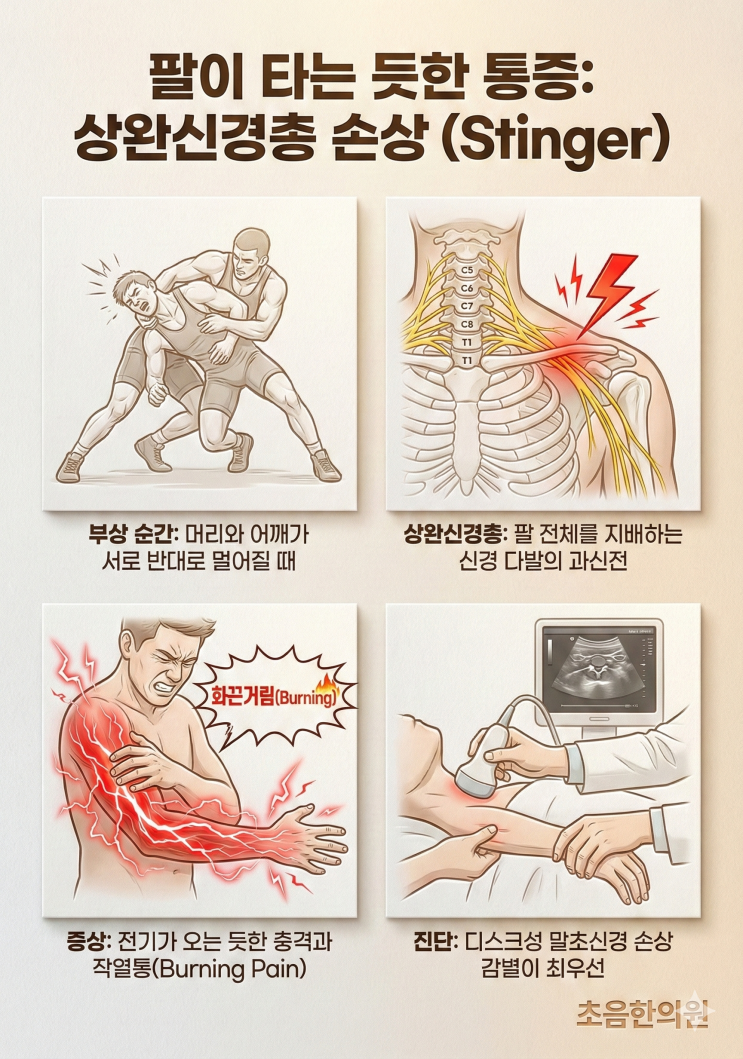 주짓수 하다 "악!" 팔에 전기가 오고 불타는 느낌? '상완신경총 손상' 증상과 치료법