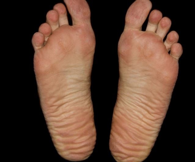 발바닥 씻는, 나오는, 물집 생기는, 허물 벗는, 핥는 꿈 해몽