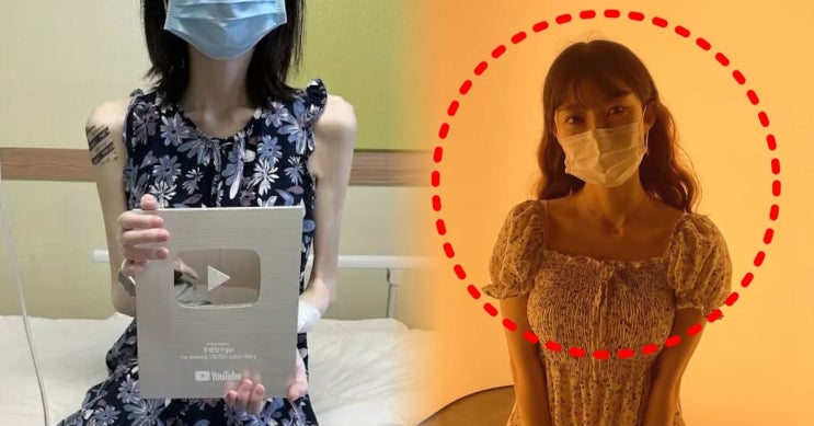  유튜버 유병장수걸 사망… 신장암 투병 끝 별세 ‘향년 28세’남자친구가 전한 마지막 인사에 추모 물결