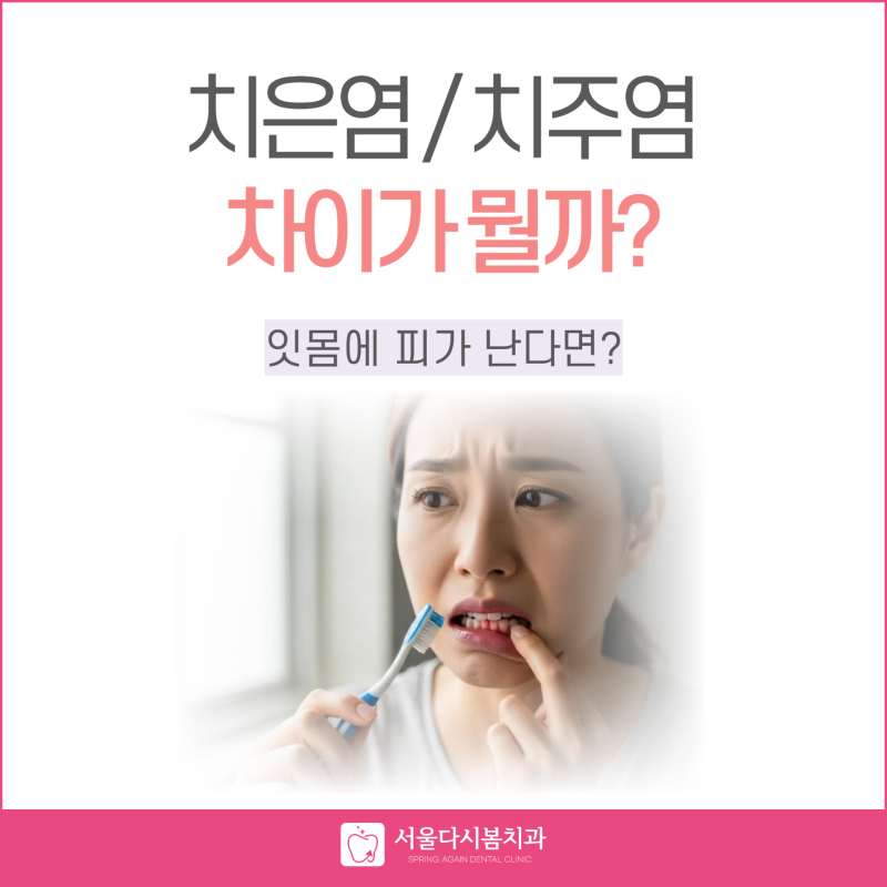 치은염 vs 치주염 잇몸병 단계 차이