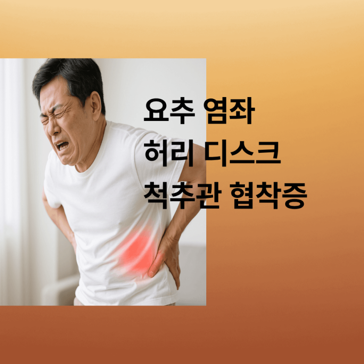  청주 지긋지긋한 허리 통증 주사 치료 1세대 베스트365의원이 답해드립니다