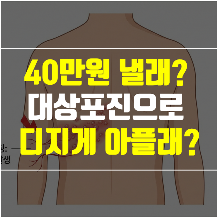  대상포진 전염성 있을까? 당뇨환자가 알아야 할 초기증상과 진료과
