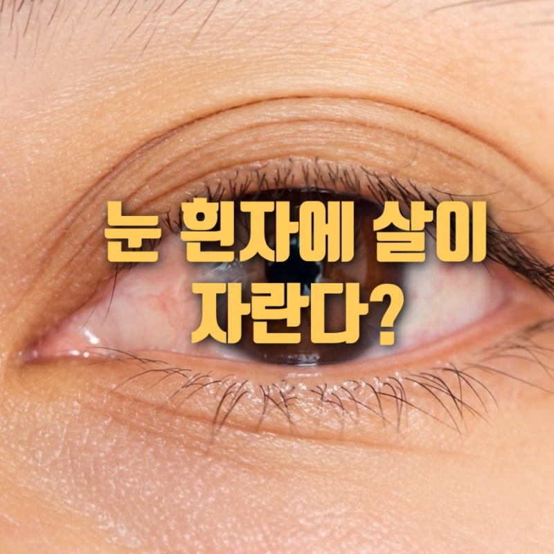 방치하면 실명 위험? 군날개 증상 · 치료 · 예방법 총정리