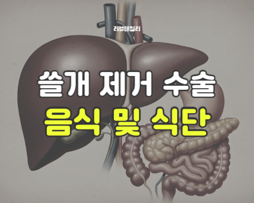 쓸개 제거 수술 후 음식 및 좋은 영양제, 회복기간: 식단 식단표 (예시)