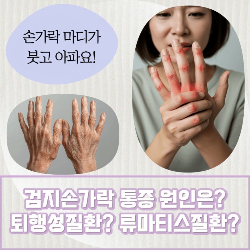 대구 달성 재발성 류마티즘 반복되는 관절 통증의 원인일 수 있습니다