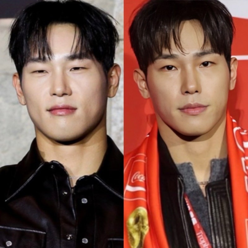 지효 남자친구 쌍커풀 수술 했나? 눈매교정? 성형 의혹에 보톡스 맞았어요