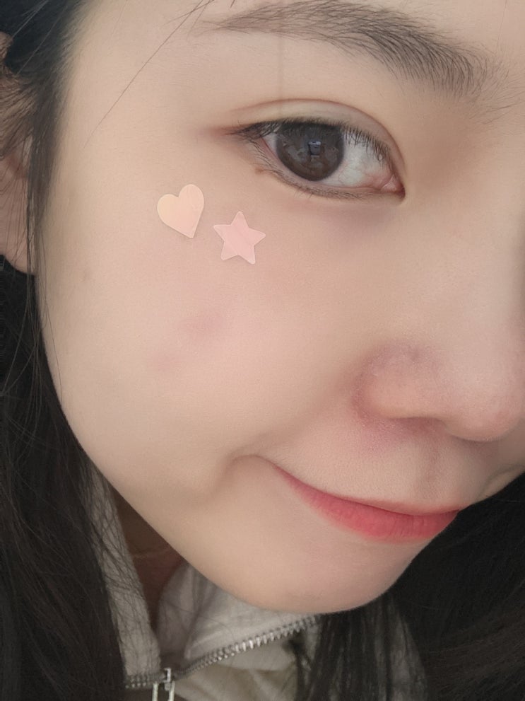  깔끔하게 붙이는 트러블패치 네오덤 홀로그램패치 후기