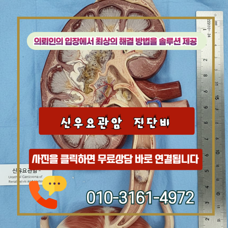  신우요관암 진단비 수령을 위한 핵심 가이드 C66 코드인데 소액암 지급?