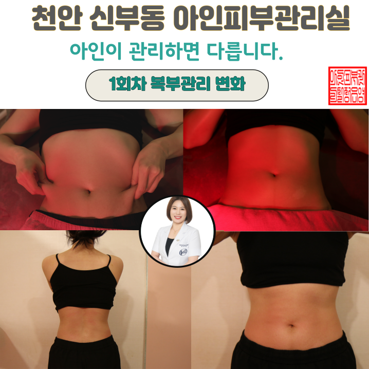  잘룩한 허리만들기 천안 두정동과 신부동 피부관리와 복부관리 아인피부관리실