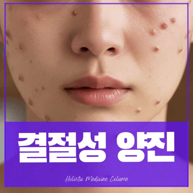 결절성양진원인, 생기는 이유 및 증상 치료방법(병원/한의원 관점)