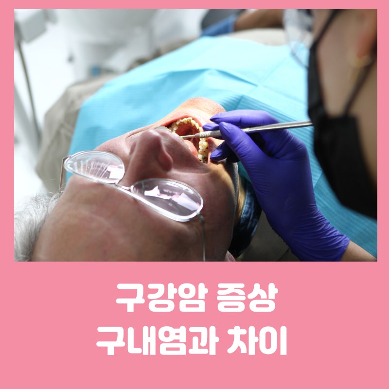 구강암 증상과 종류 (구강 내 질환과 차이)