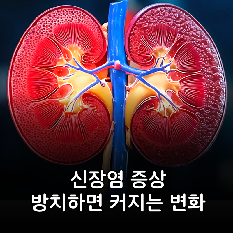 허리만 아픈 게 아닙니다! 신장염 증상, 방치하면 커지는 변화 5가지