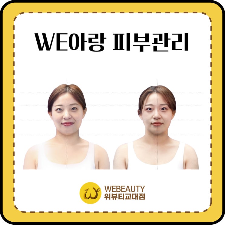  한쪽 입꼬리만 올라간다면? 얼굴 비대칭 자가진단법과 추천하는 경락 마사지?
