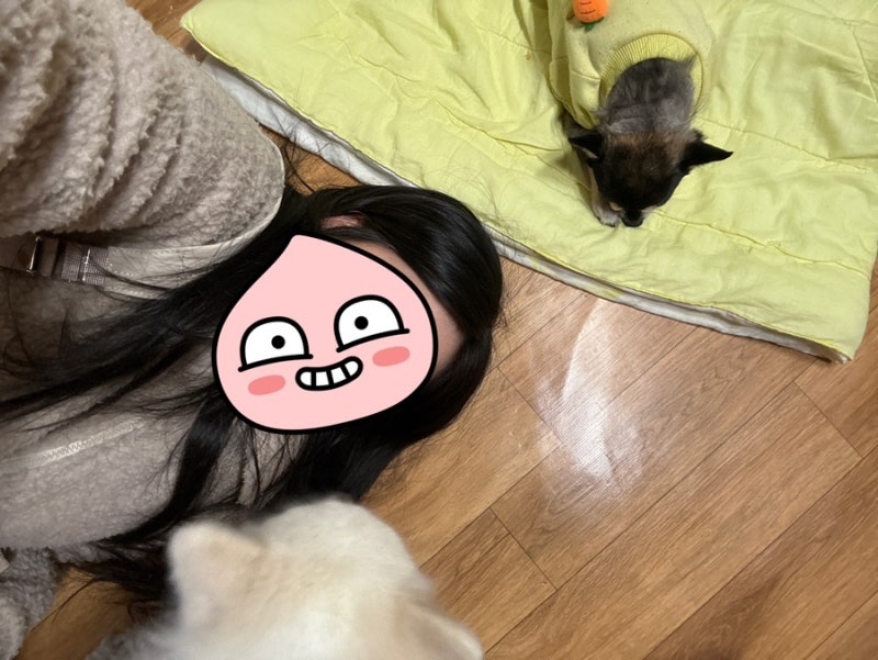 발목 골절 수술 2주차 후기