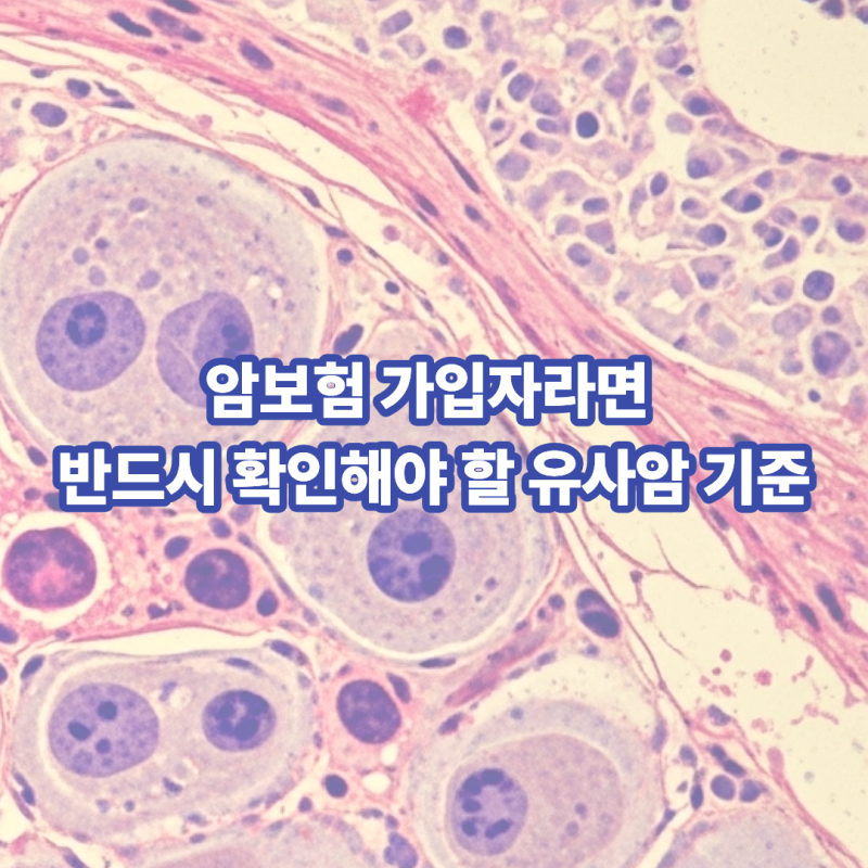 암보험 가입자라면 반드시 확인해야 할 유사암 기준