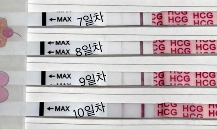  시험관1차 ep.13 배아 이식 후 10일차 까지 임테기 진하기, 1차 피검사 결과 까지!