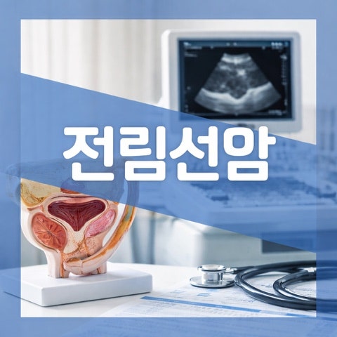 전립선암 생존율 1기 2기 3기 4기 병기별 치료 방법