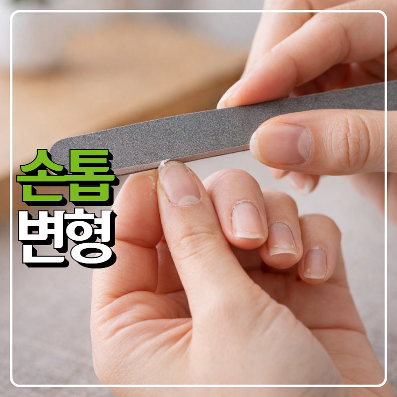 손톱변형과 깨짐, 조갑박리증&조갑이영양증 증상