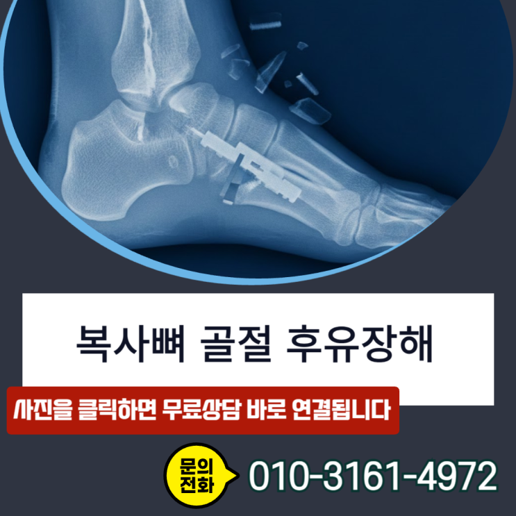 복사뼈 골절 후유장해, 숨겨진 보험금 찾는 손해사정사의 노하우