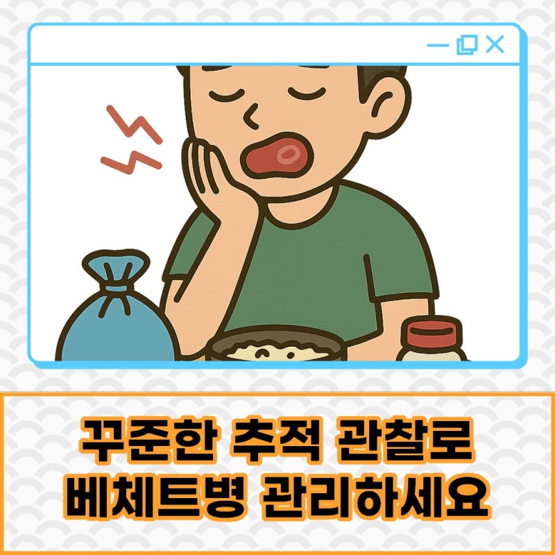베체트병 치료 증상에 따른 체계적인 약물 관리가 중요합니다