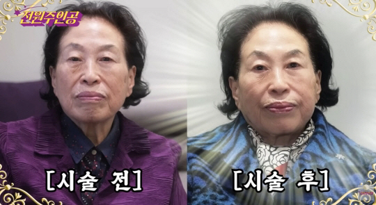   배우 전원주 500만원 리프팅 시술 근황 전원주 피부과 리프팅·울세라·보톡스까지… “10년만 젊어지고 싶다” 솔직 고백 